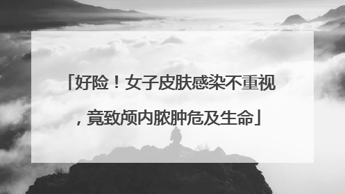 好险！女子皮肤感染不重视，竟致颅内脓肿危及生命
