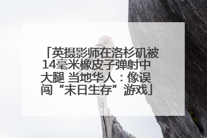 英摄影师在洛杉矶被14毫米橡皮子弹射中大腿 当地华人：像误闯“末日生存”游戏